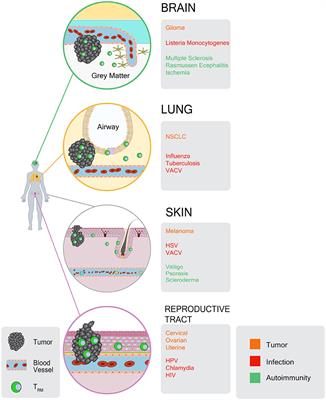 Tissue Resident CD8 Memory T Cell Responses in Cancer and Autoimmunity